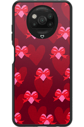My Heart My Love - Xiaomi Poco X3 Pro