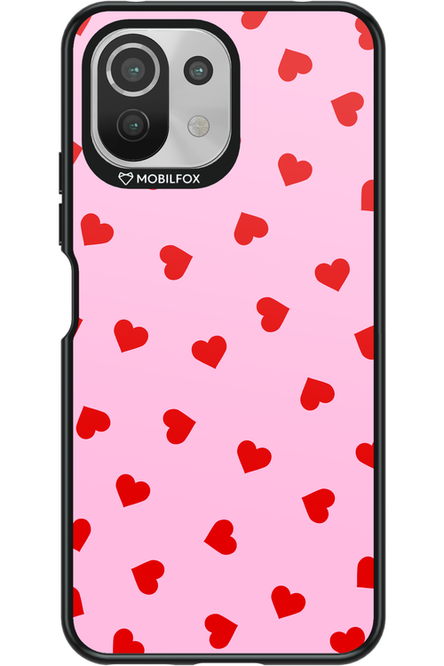 Sprinkle Heart Pink - Xiaomi Mi 11 Lite (2021)