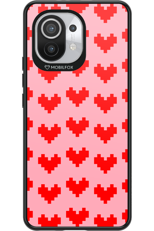 Heart Game - Xiaomi Mi 11 5G