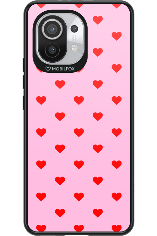 Simple Sweet Pink - Xiaomi Mi 11 5G