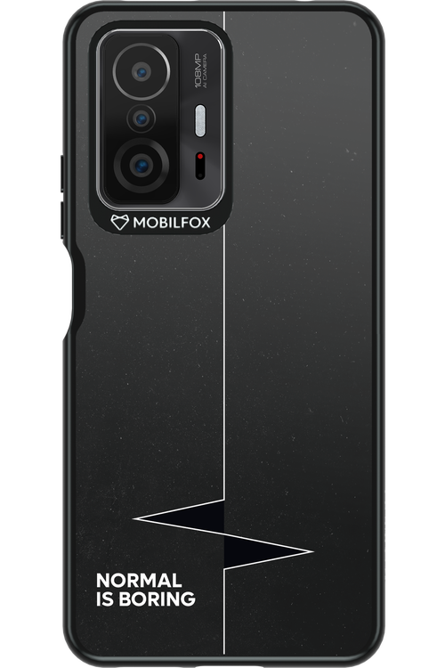 Normal Is Boring - Xiaomi Mi 11T