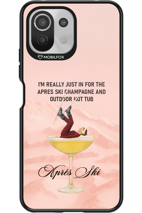 Champagne Tub - Xiaomi Mi 11 Lite (2021)