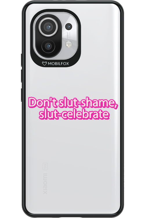 Slut - Xiaomi Mi 11 5G