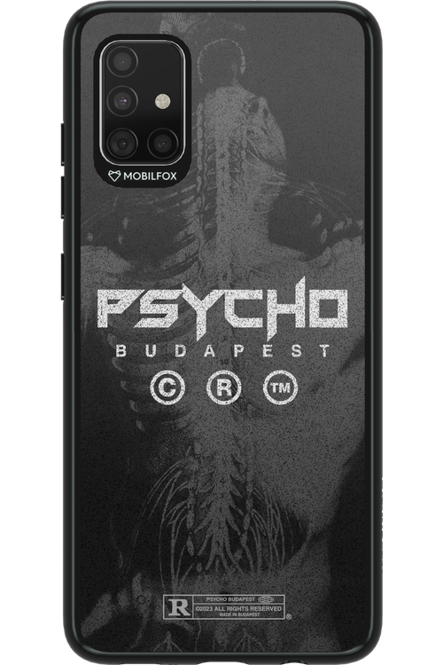 X-Ray - Samsung Galaxy A51