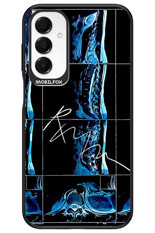 RMN Scolioza 2.0 - Samsung A16