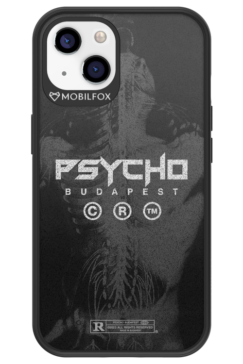 X-Ray - Apple iPhone 13