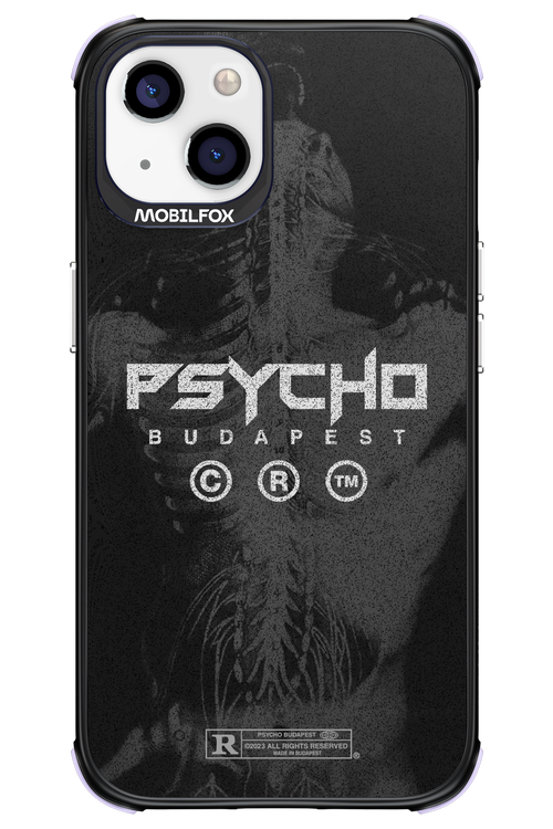X-Ray - Apple iPhone 13