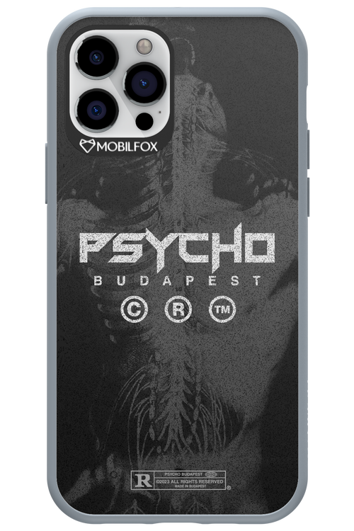 X-Ray - Apple iPhone 12 Pro