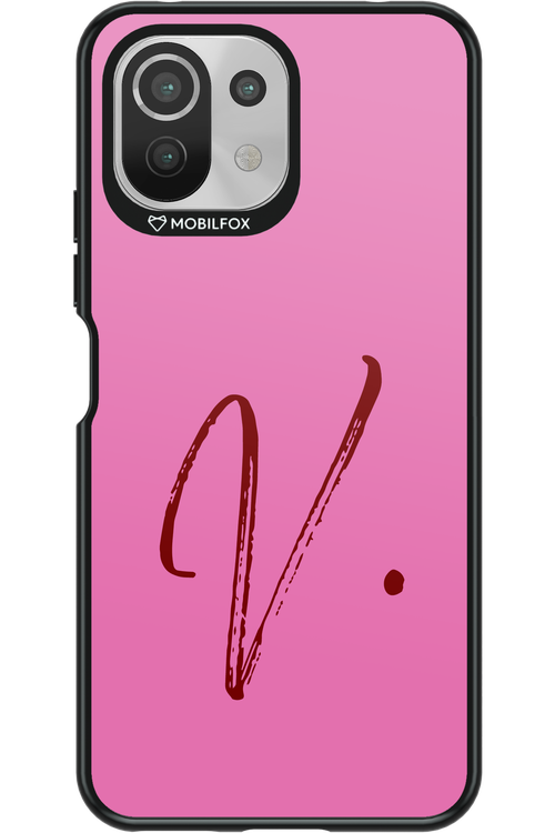 (Sorbet) V - Xiaomi Mi 11 Lite (2021)