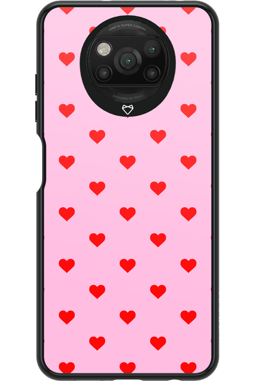 Simple Sweet Pink - Xiaomi Poco X3 NFC