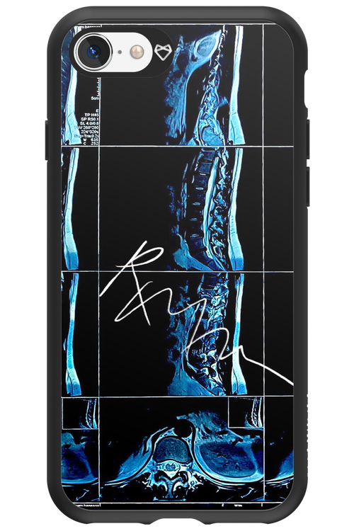 RMN Scolioza 2.0 - Apple iPhone SE 2020