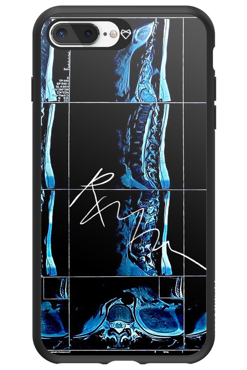RMN Scolioza 2.0 - Apple iPhone 8 Plus