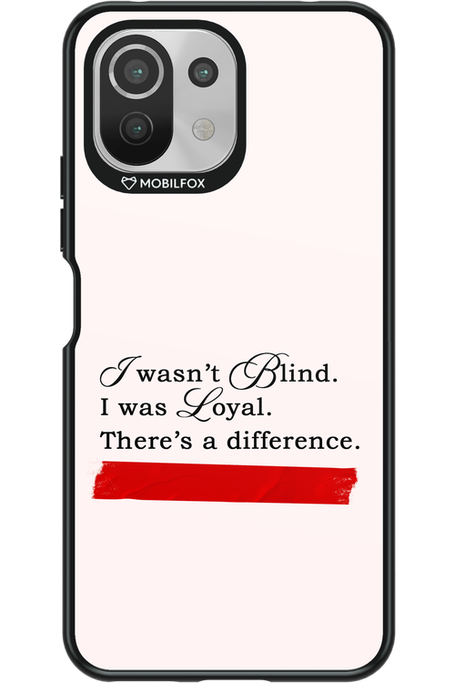 Difference 2.0 - Xiaomi Mi 11 Lite (2021)