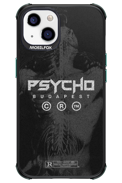 X-Ray - Apple iPhone 13