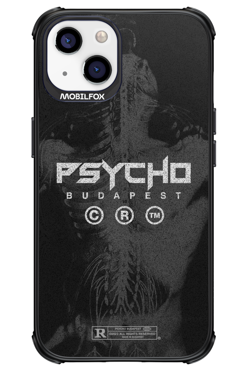 X-Ray - Apple iPhone 13