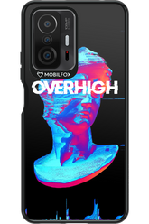 Overhigh - Xiaomi Mi 11T