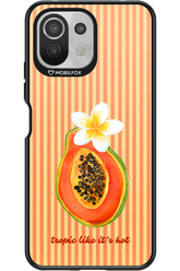 Hot Tropic 2.0 - Xiaomi Mi 11 Lite (2021)