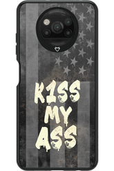 KISS II 2.0 - Xiaomi Poco X3 NFC