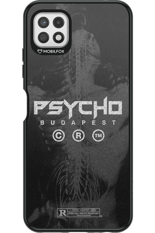 X-Ray - Samsung Galaxy A22 5G