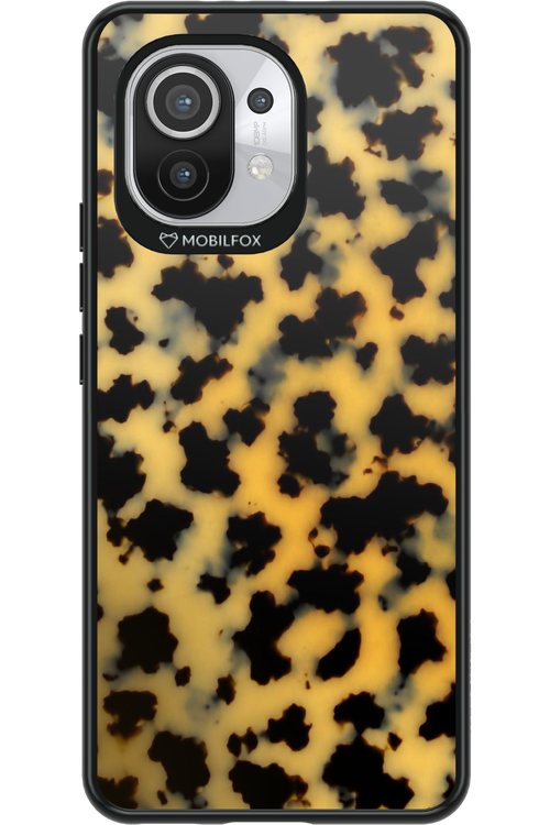 Tortoiseshell 2.0 - Xiaomi Mi 11 5G