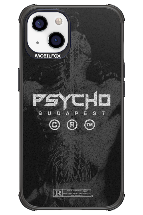 X-Ray - Apple iPhone 13