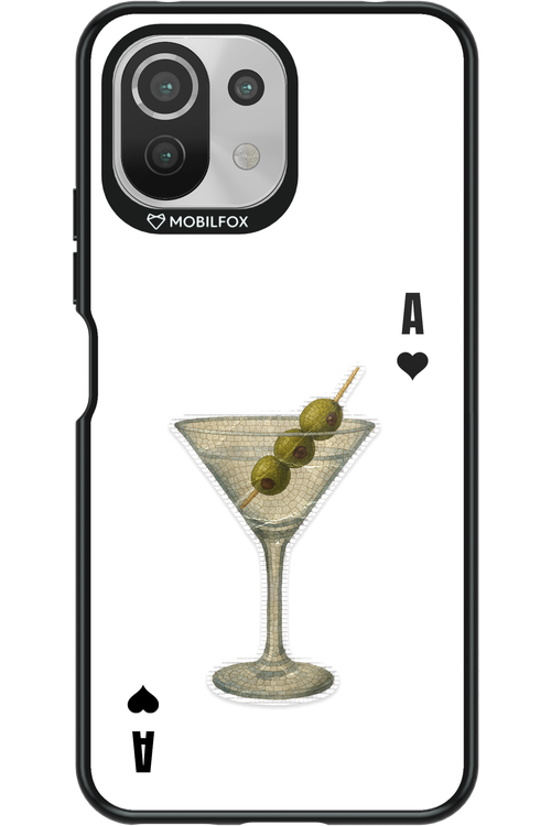 MartiniAce 2.0 - Xiaomi Mi 11 Lite (2021)