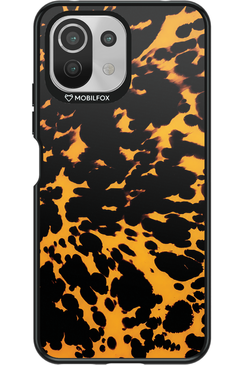Tortoise Shell 2.0 - Xiaomi Mi 11 Lite (2021)