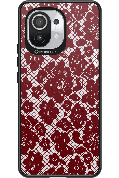 Lace Lover - Xiaomi Mi 11 5G