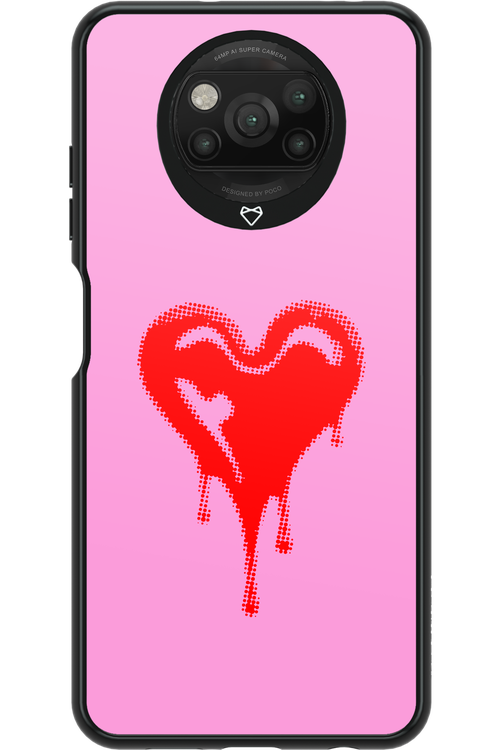 Heart Pink - Xiaomi Poco X3 NFC