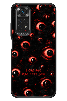 The Watchers - Xiaomi Redmi Note 11/11S 4G