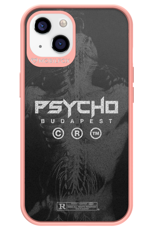 X-Ray - Apple iPhone 13