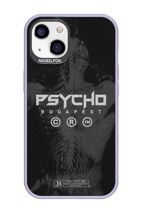 X-Ray - Apple iPhone 13