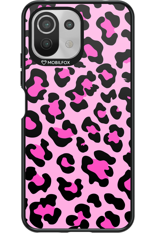 PINK LEOPARD - Xiaomi Mi 11 Lite (2021)