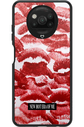 New Era 2.0 - Xiaomi Poco X3 Pro