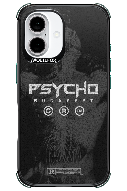 X-Ray - Apple iPhone 16