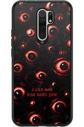 The Watchers - Xiaomi Redmi 9