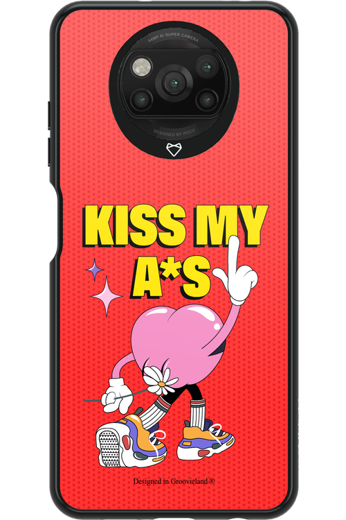 KISS - Xiaomi Poco X3 NFC