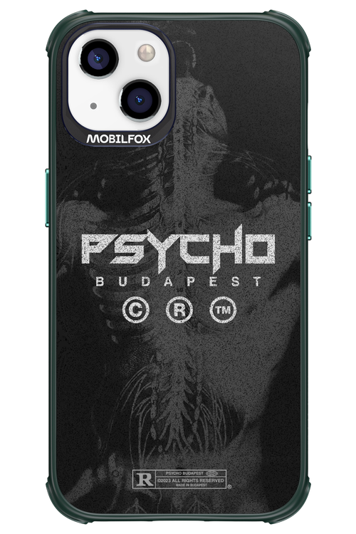 X-Ray - Apple iPhone 13