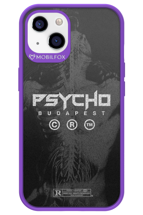 X-Ray - Apple iPhone 13