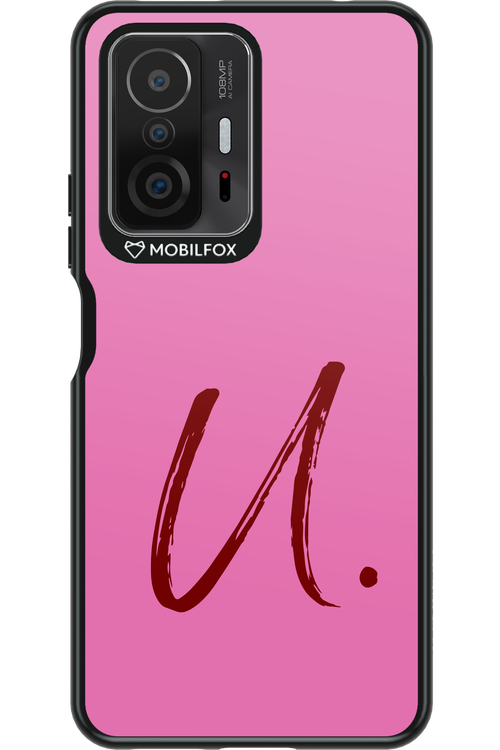 (Sorbet) U 2.0 - Xiaomi Mi 11T Pro