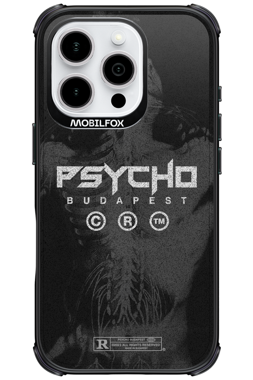 X-Ray - Apple iPhone 16 Pro