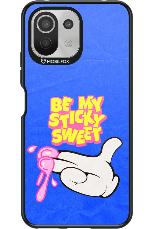 be my sticky sweet 2.0 - Xiaomi Mi 11 Lite (2021)