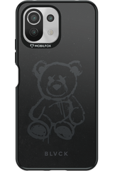 BLVCK BEAR 2.0 - Xiaomi Mi 11 Lite (2021)