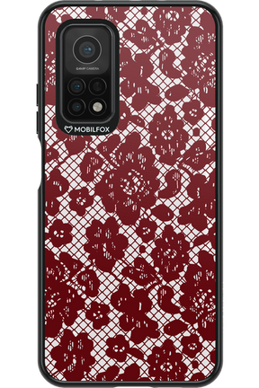 Lace Lover - Xiaomi Mi 10T 5G