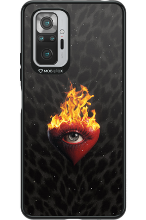 Shit happens - Xiaomi Redmi Note 10S